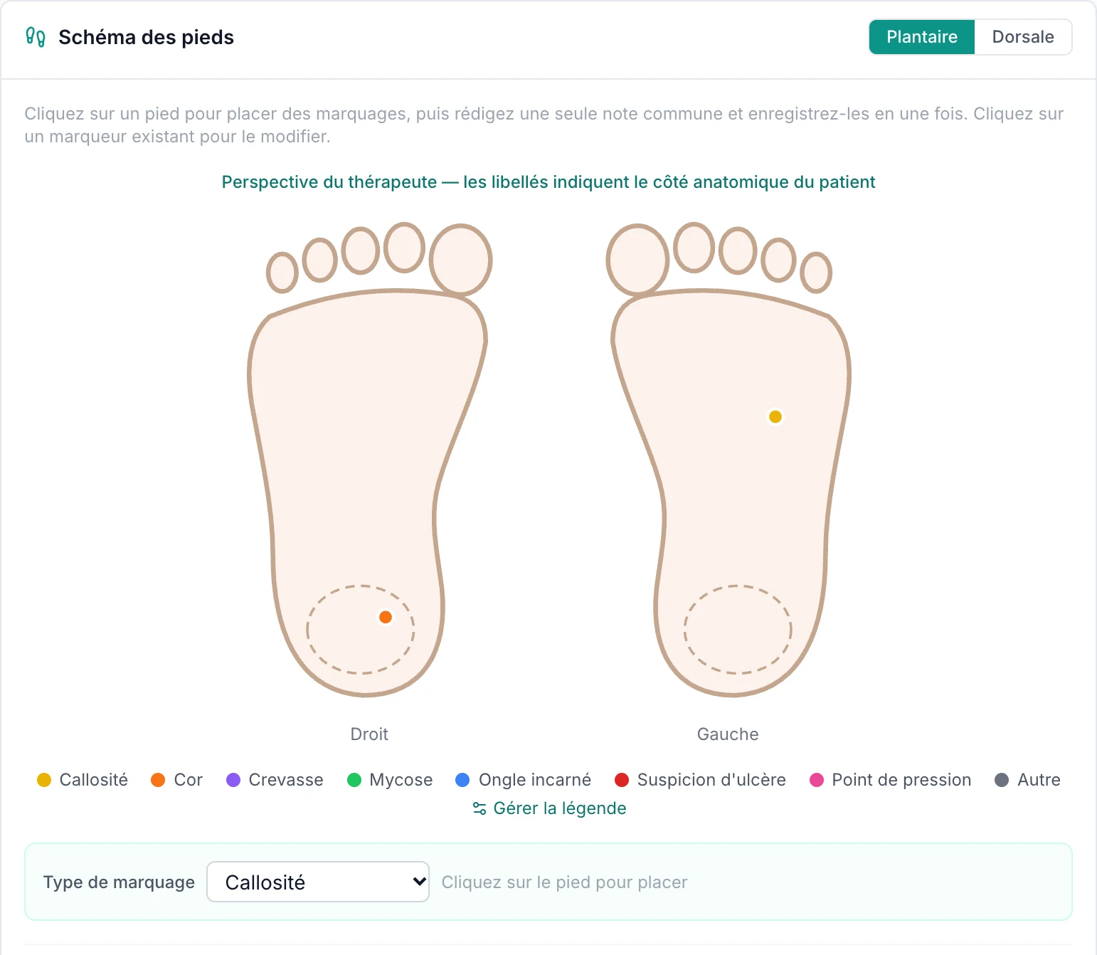 Schéma des pieds dans le dossier VIMA avec une vue plantaire du pied droit et du pied gauche et une légende des types de marquage